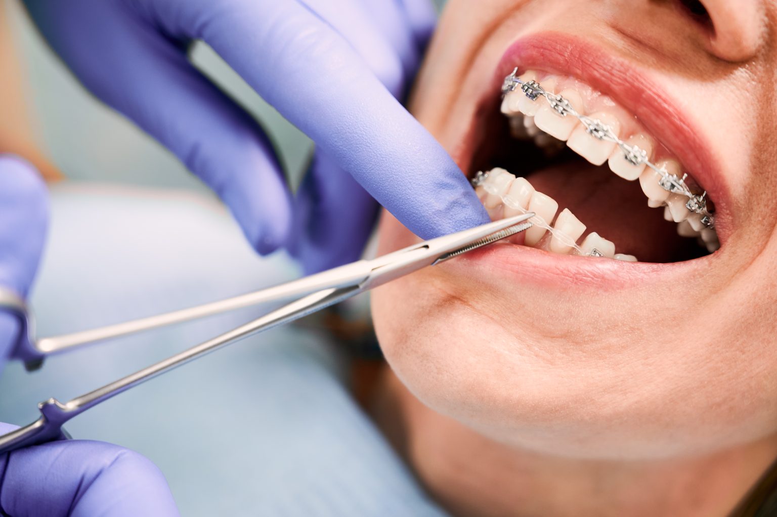 What is Orthodontics? - Dental Health News